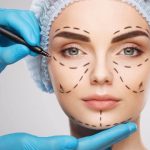 Transforming Perceptions: The Evolution of Plastic Surgery